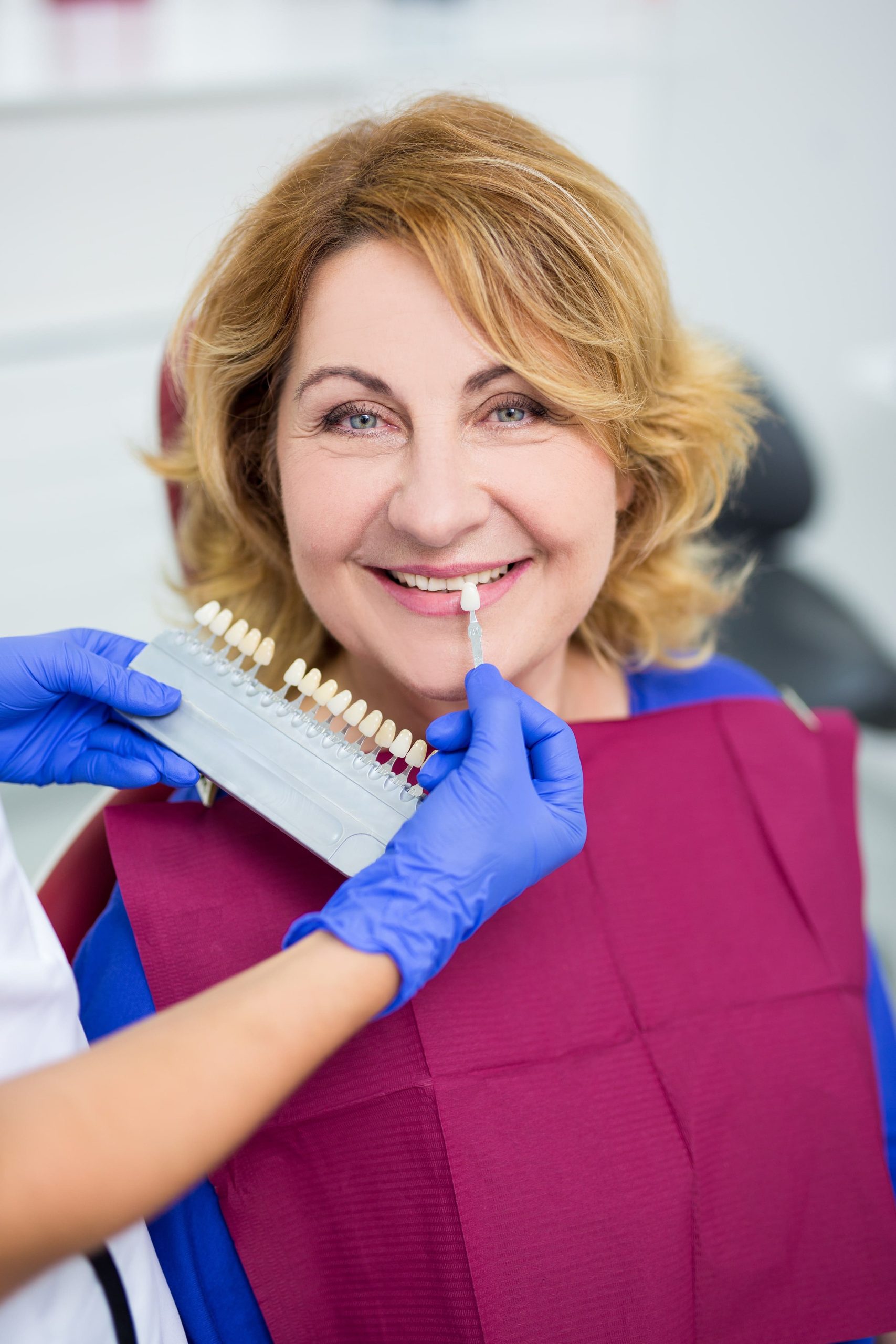 Veneers